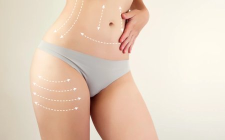 Your Guide to Liposuction Surgery in Dubai Selecting the Right Clinic