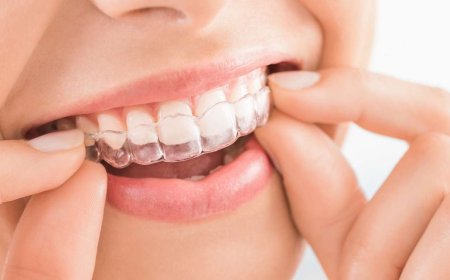 The Cost of Invisalign in Dubai: What’s Included in the Treatment?