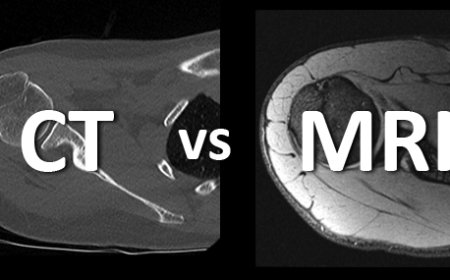 Difference Between MRI, CT Scan, and X-ray