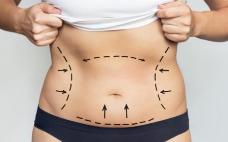 Exceptional Liposuction Outcomes from Best Liposuction Doctors in Dubai