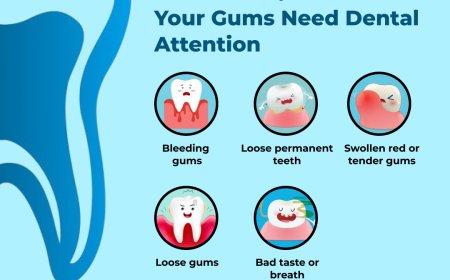 Best Dental Clinic in Hoodi Bangalore: Your Guide to Quality Oral Care